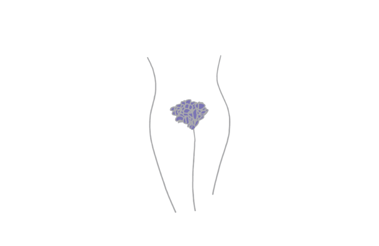 illustrasjon underliv med blomster hudsykdommer